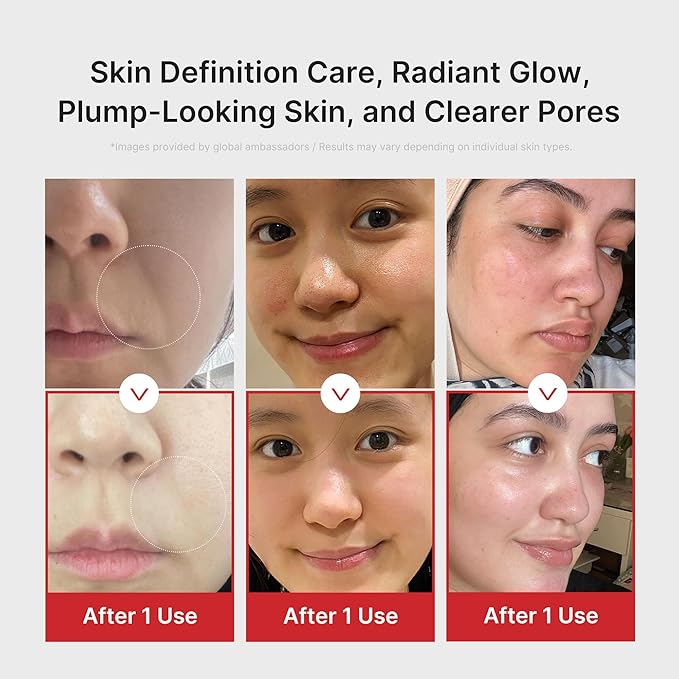 Medicube AGE-R Booster Pro | Advanced Skin Care Device